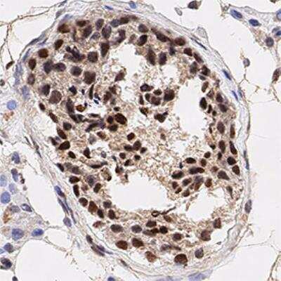 Immunohistochemistry-Paraffin: Histone H3 [p Ser10] Antibody [NB21-1091] - Analysis of FFPE human testis using Histone H3 [pS10] antibody at 1:500 on a Bond Rx autostainer (Leica Biosystems). The assay involved 20 minutes of heat induced antigen retrieval (HIER) using 10 mM sodium citrate buffer (pH 6.0) and endogenous peroxidase quenching with peroxide block. The sections were incubated with primary antibody for 30 minutes and Bond Polymer Refine Detection (Leica Biosystems) with DAB was used for signal development followed by counterstaining with hematoxylin. Whole slide scanning and capturing of representative images was performed using Aperio AT2 (Leica Biosystems). Nuclei staining of Histone H3 was observed. Staining was performed by Histowiz.